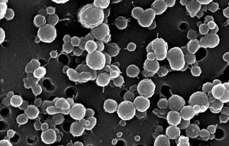 Bacterii care traiesc fara lumina si fara oxigen, descoperite intr-un lac din Antarctica