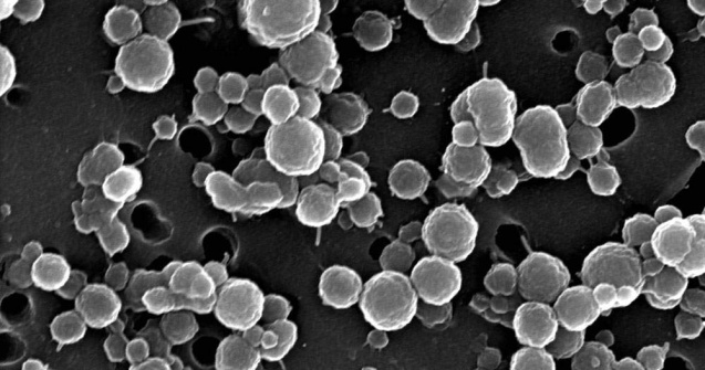 Bacterii care traiesc fara lumina si fara oxigen, descoperite intr-un lac din Antarctica