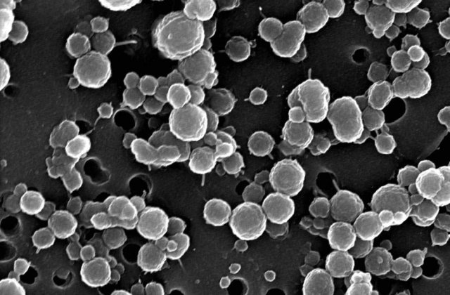 Bacterii care traiesc fara lumina si fara oxigen, descoperite intr-un lac din Antarctica