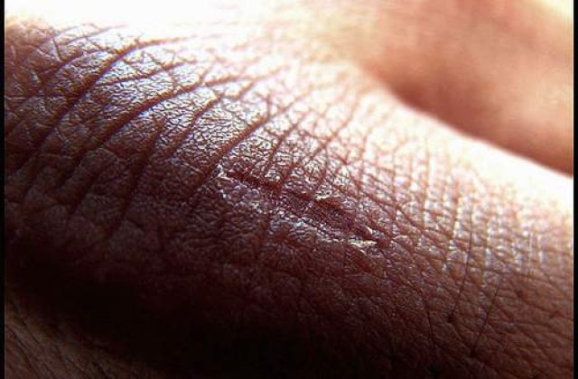 A fost descoperita pielea artificiala