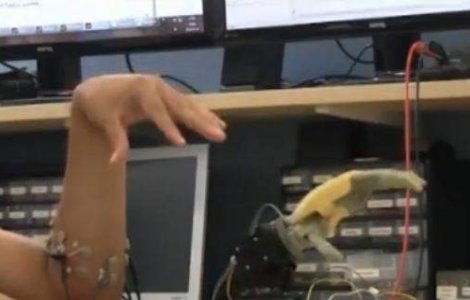 Descoperire remarcabila in medicina: Proteze implantate direct pe os