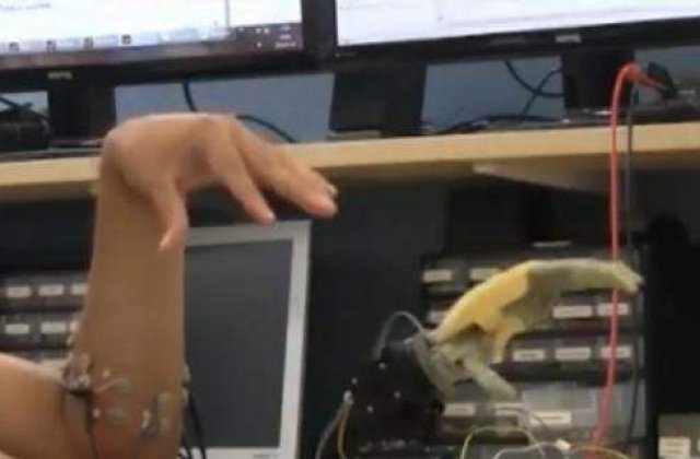 Descoperire remarcabila in medicina: Proteze implantate direct pe os