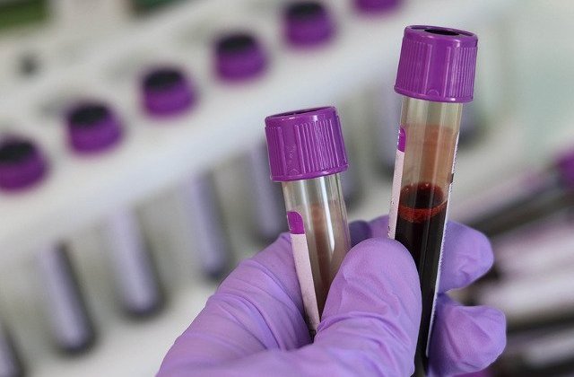 Plasma din sangele persoanelor vindecate de coronavirus poate salva vietile celor in stare critica