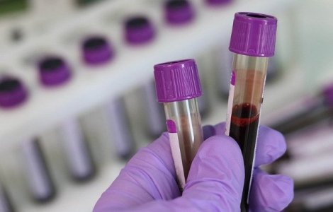 Plasma din sangele persoanelor vindecate de coronavirus poate salva al