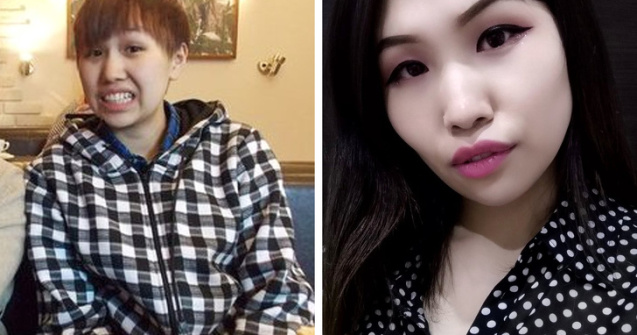  Top  15+ persoane care au trecut prin schimbari drastice ale aspectului