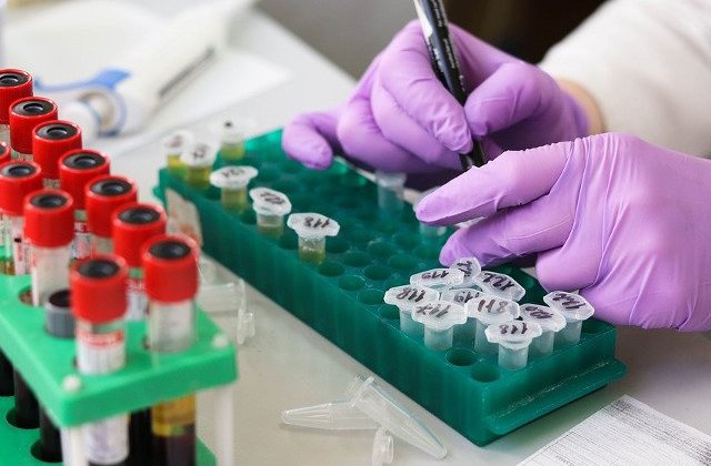 Antibioticele nu ajuta la prevenirea sau la tratarea coronavirusului