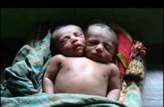 VIDEO: Bebelus cu 2 capete, nascut in Filipine