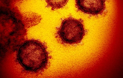Coronavirus: tot ce trebuie sa stii despre epidemie, transmitere, simptome,