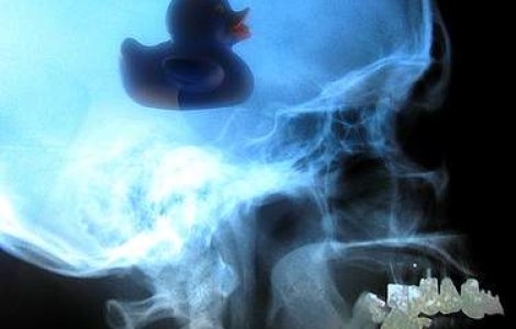 Un caine a mancat noua mingi de golf si un glont