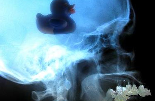 Un caine a mancat noua mingi de golf si un glont