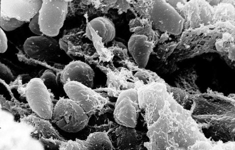 China, lovita de ciuma pneumonica