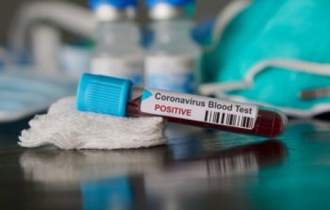 Un barbat infectat cu coronavirus a intrat in contact cu peste 1000 de persoane