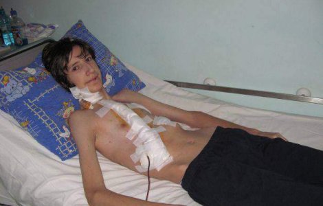 Medic roman, creatorul unei operatii care ar putea salva mii de copii