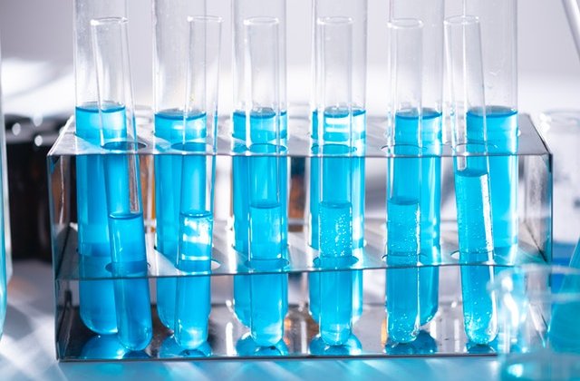 Rafila: Probabil spre sfârștiul lunii aprilie vom avea mii de cazuri de Covid-19 zilnic. Deja suntem în situația Italiei