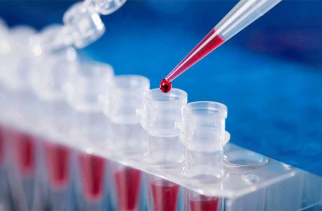 340.000 de teste de coronavirus false, cumpărate din China. Ce reacție a avut Beijingul