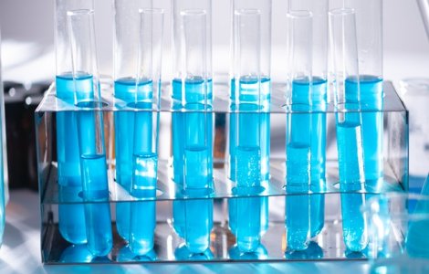 Numărul cazurilor de Covid-19 confirmate în Lombardia continuă să crească în ciuda măsurilor luate. Iată de ce