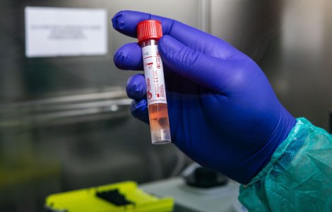 Teste pentru detectarea coronavirusului, deja contaminate cu noul virus