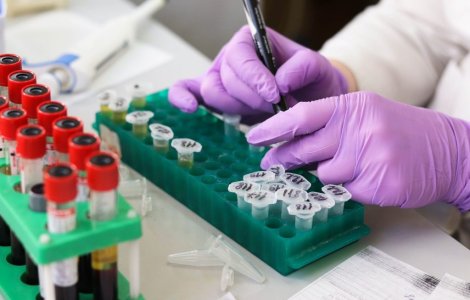 Care este cea mai vulnerabilă grupă sanguină în fața infecției cu coronavirus