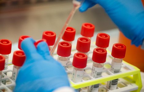 Românii au creat aplicația care îți spune dacă ai putea avea coronavirus