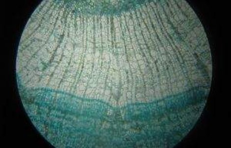 Un ziar suedez acuza: Armata israeliana a facut trafic cu organe prelevate de la palestinieni