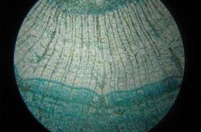 Un ziar suedez acuza: Armata israeliana a facut trafic cu organe prelevate de la palestinieni