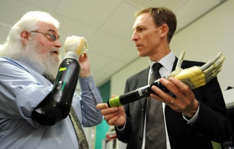 Prima mana bionica Touch i-LIMB