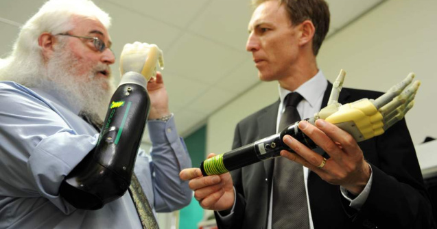 Prima mana bionica Touch i-LIMB