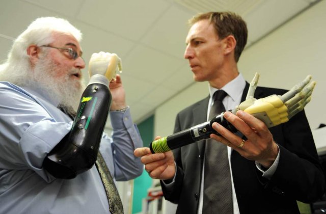 Prima mana bionica Touch i-LIMB