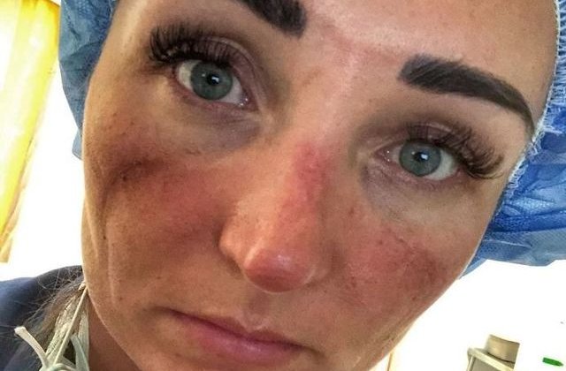 Așa arată fața unui medic care luptă &icirc;n prima linie cu noul coronavirus