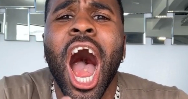 VIDEO Jason Derulo a rămas fără dinți după o provocare pe TikTok