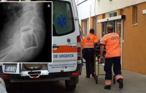 A ajuns la spital cu un borcan în fund. Anul trecut a ajuns cu un pahar