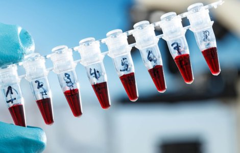 Câți bucureșteni s-au înscris deja pentru testele gratuite de coronavirus