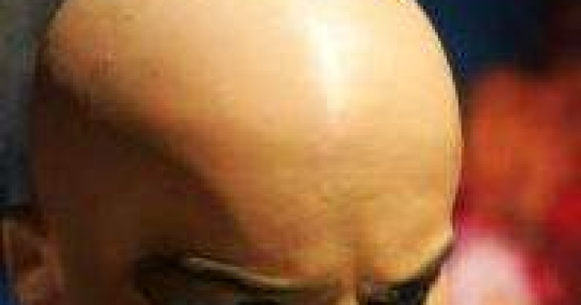  Top  Cum aratau inainte sa-si piarda parul? 10 imagini cu vedete in perioada pre-chelie