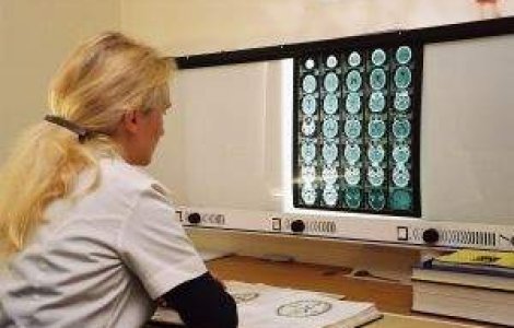 Lista de asteptare pentru bolnavii de cancer, redusa cu 42%