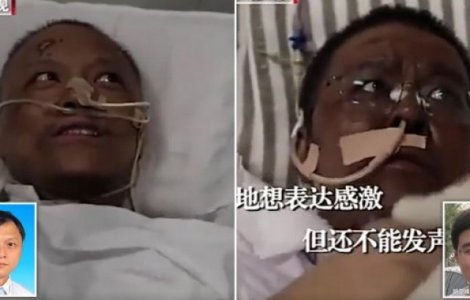 Unul din medicii care a devenit de culoare a murit. Celălalt s-a recuperat