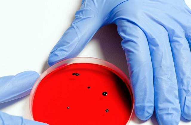 Transplant cu organe create &icirc;n laborator. Ce &icirc;nseamă asta pentru omenire