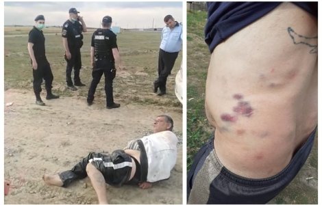 Un căruțaș acuză polițiștii și jandarmii din Constanța că l-au bătut degeaba