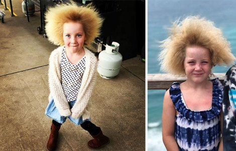  Top  Cele mai frumoase greșeli ale naturii: 7 persoane cu înfățișări unice