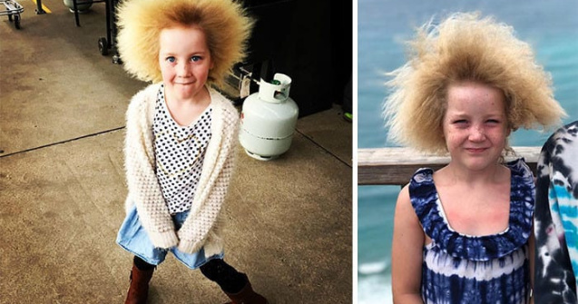  Top  Cele mai frumoase greșeli ale naturii: 7 persoane cu înfățișări unice