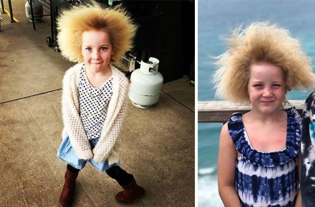 Cele mai frumoase greșeli ale naturii: 7 persoane cu înfățișări unice