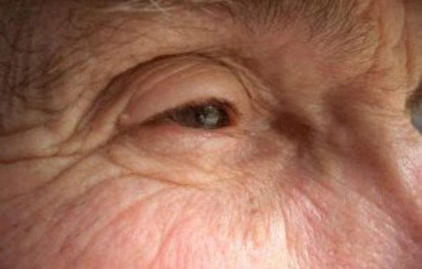 Olanda: Batranii sanatosi, plictisiti de viata, vor primi dreptul sa fie eutanasiati