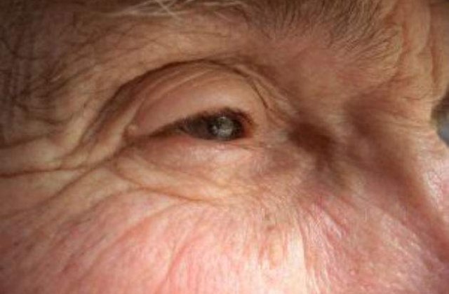 Olanda: Batranii sanatosi, plictisiti de viata, vor primi dreptul sa fie eutanasiati