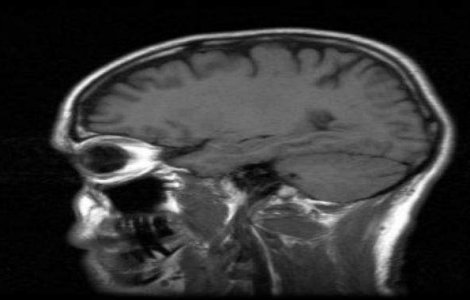 Studiu: Tomografiile, metoda eficienta pentru a prezice durata unei relatii