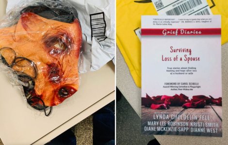 Cuplu de bloggeri, terorizat de angajați ai eBay: le trimiteau fetuși de porc morți, larve și păianjeni vii