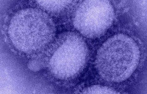G4 EA H1N1: Un nou tip de gripă porcină cu potențial pandemic, descoperit în China