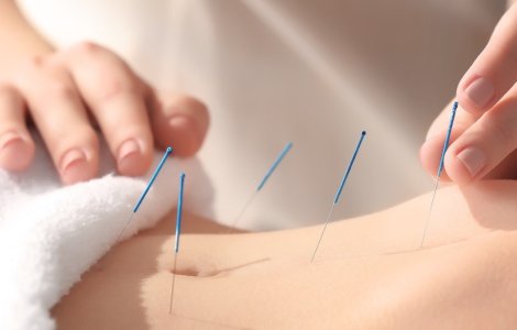 Cabinetul de acupuncturabucuresti.ro îți oferă alinare în multiple situații