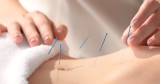 Cabinetul de acupuncturabucuresti.ro îți oferă alinare în multiple situații: află care sunt acestea!