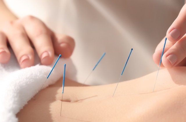 Cabinetul de acupuncturabucuresti.ro îți oferă alinare în multiple situații: află care sunt acestea!