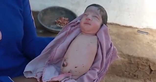 VIDEO O fetiță s-a născut fără mâini și fără picioare. Medicii și familia au rămas muți de uimire