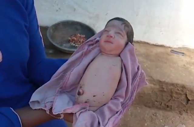 VIDEO O fetiță s-a născut fără mâini și fără picioare. Medicii și familia au rămas muți de uimire